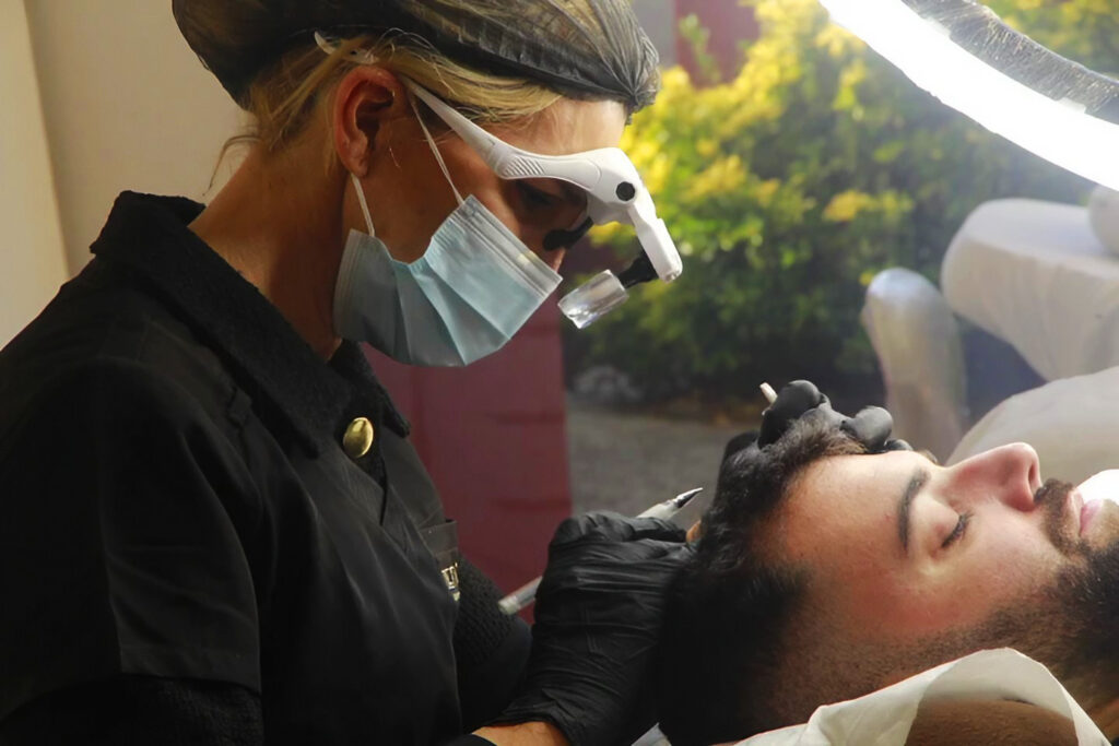 micropigmentacion-capilar